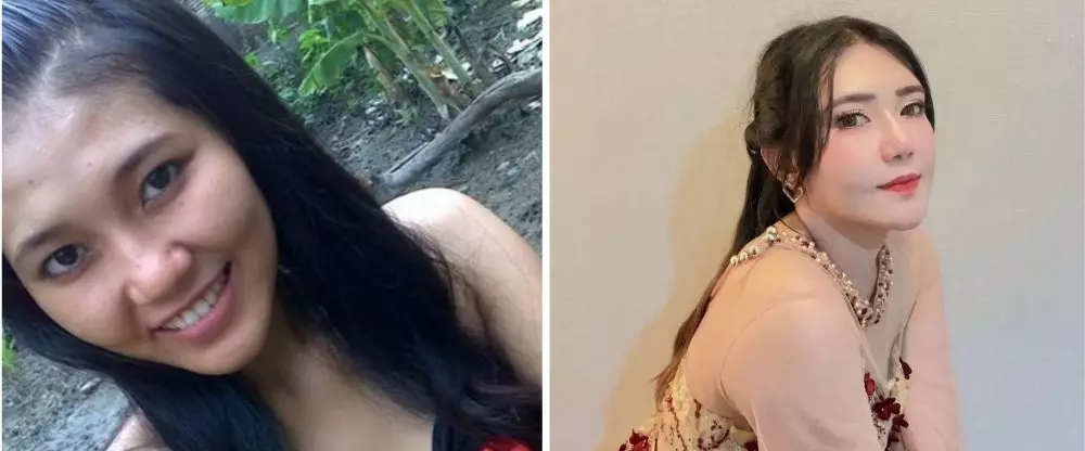 Potret dulu dan kini Via Vallen © Instagram