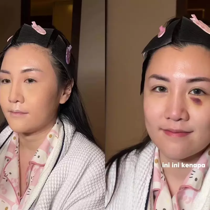 Punya bekas memar di wajah, MUA ini sukses bikin wajah pengantin jadi flawless bak princess