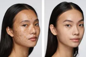 Cuma butuh 7 hari, begini cara menghilangkan flek hitam secara alami