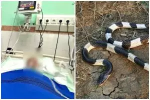 5 Kronologi bocah usia 11 tahun meninggal usai digigit ular weling, 1 bulan dirawat melawan bisa