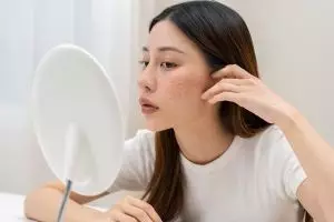 Apa bedanya kulit kering dan dehidrasi? Ini penjelasan lengkap dari ahli dermatologi biar makin paham