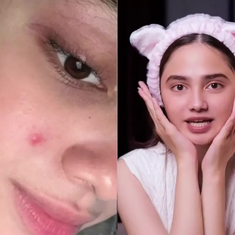 Tak pernah pakai acne patch, begini cara Syifa Hadju atasi jerawat di wajah agar cepat kempis