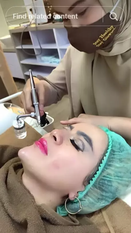 Yuni Jasmine seleb TikTok dagu lancip tanpa filter © TikTok