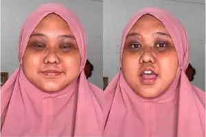 Lingkaran hitam di mata auto minggat, wanita ini tunjukkan transformasinya usai dirias manten Sunda
