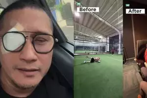 Mata kena lemparan bola saat main padel, begini kondisi Arie Untung usai dilarikan ke rumah sakit