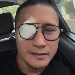 Mata kena lemparan bola saat main padel, begini kondisi Arie Untung usai dilarikan ke rumah sakit