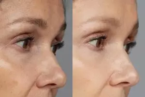 Buah satu ini bisa jadi masker kolagen untuk atasi garis halus di wajah, begini cara pakainya