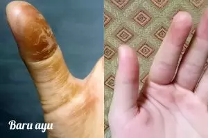 Cara jitu hilangin getah labu siam di tangan, nggak perlu sabun!