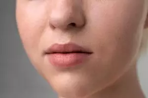 Bibir hitam akibat hiperpigmentasi? Terkuak cara alami bikin cerah dalam 7 hari, pakai 3 bahan dapur