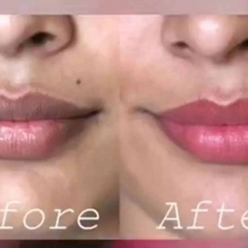 Bibir gelap dan kering bikin nggak nyaman? Coba scrub dari 3 bahan dapur ini agar jadi pink alami