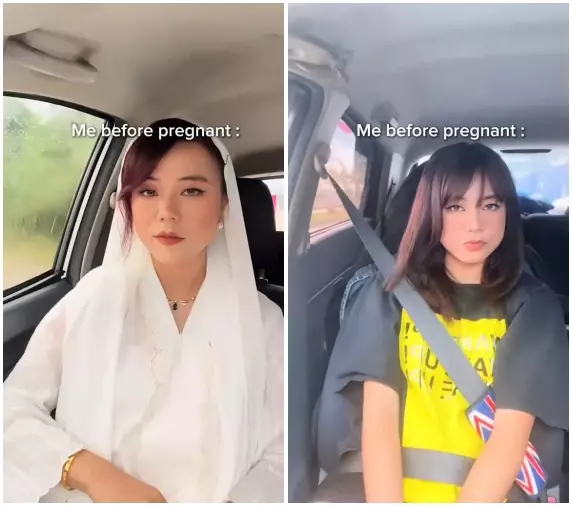 Usaha ibu hamil perbaiki wajah karena kehamilan © 2025 TikTok Usaha ibu hamil perbaiki wajah karena kehamilan © 2025 TikTok