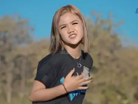 Icha Chellow sebelum oplas © TikTok Icha Chellow sebelum oplas © TikTok
