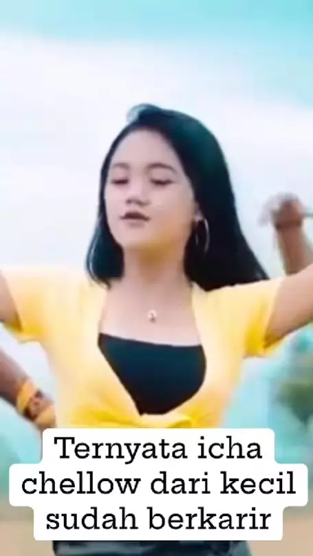 Icha Chellow sebelum oplas © TikTok Icha Chellow sebelum oplas © TikTok