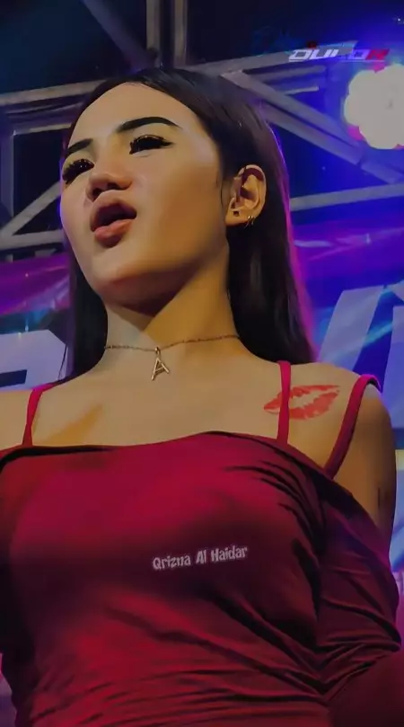 Icha Chellow sebelum oplas © TikTok Icha Chellow sebelum oplas © TikTok