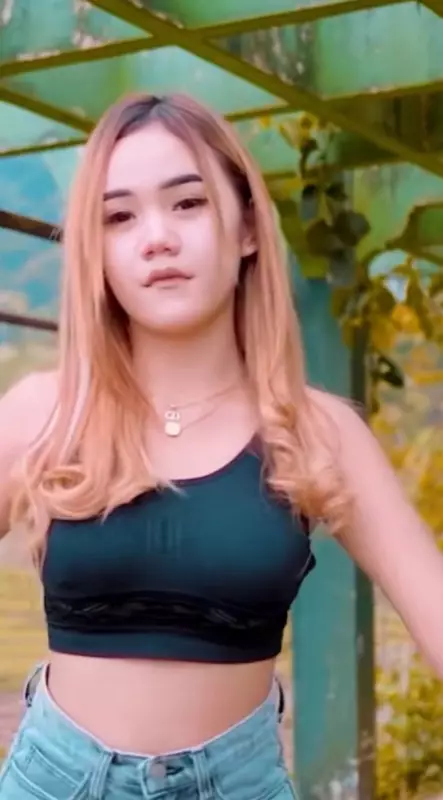 Icha Chellow sebelum oplas © TikTok Icha Chellow sebelum oplas © TikTok