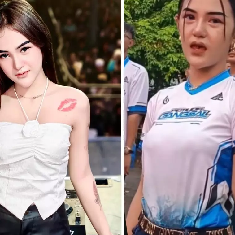 9 Potret Icha Chellow artis viral sound horeg sebelum oplas, perubahan hidungnya bikin pangling