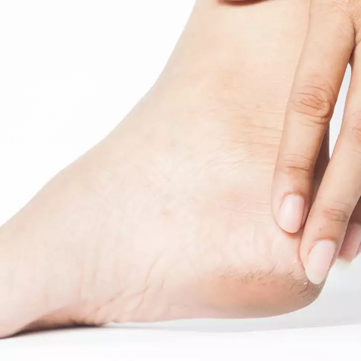 Pakai petroleum jelly tapi tak mempan? Ini cara haluskan tumit pecah dan kasar pakai 2 jenis minyak