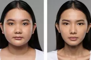 7 Cara meniruskan pipi secara alami tanpa operasi, terbukti efektif