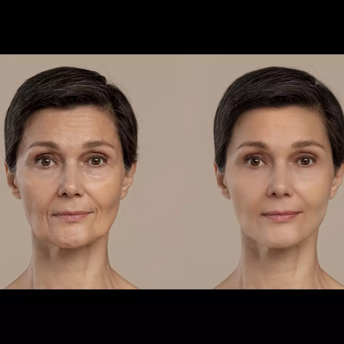 Kulit Sensitif? Ini 10 serum mengatasi kerutan tanpa iritasi dengan kandungan bakuchiol