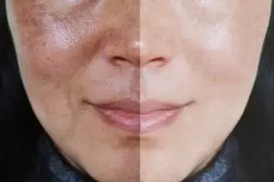 Glowing bak perawatan mahal, ini cara mencerahkan wajah kusam jadi putih modal Rp 2.000