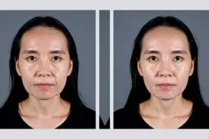 Rahasia kulit kencang dan awet muda di usia 40+, ternyata perawatannya sesimpel ini