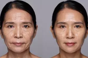 Kerutan memudar dalam 2 minggu, ini 5 rahasia cantik yang banyak dicari