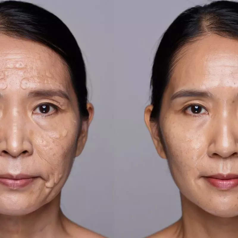 Kerutan memudar dalam 2 minggu, ini 5 rahasia cantik yang banyak dicari