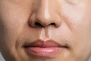 Lelah dengan pori-pori besar yang bikin wajah kusam? Begini cara jitu  mengatasinya agar kulit mulus