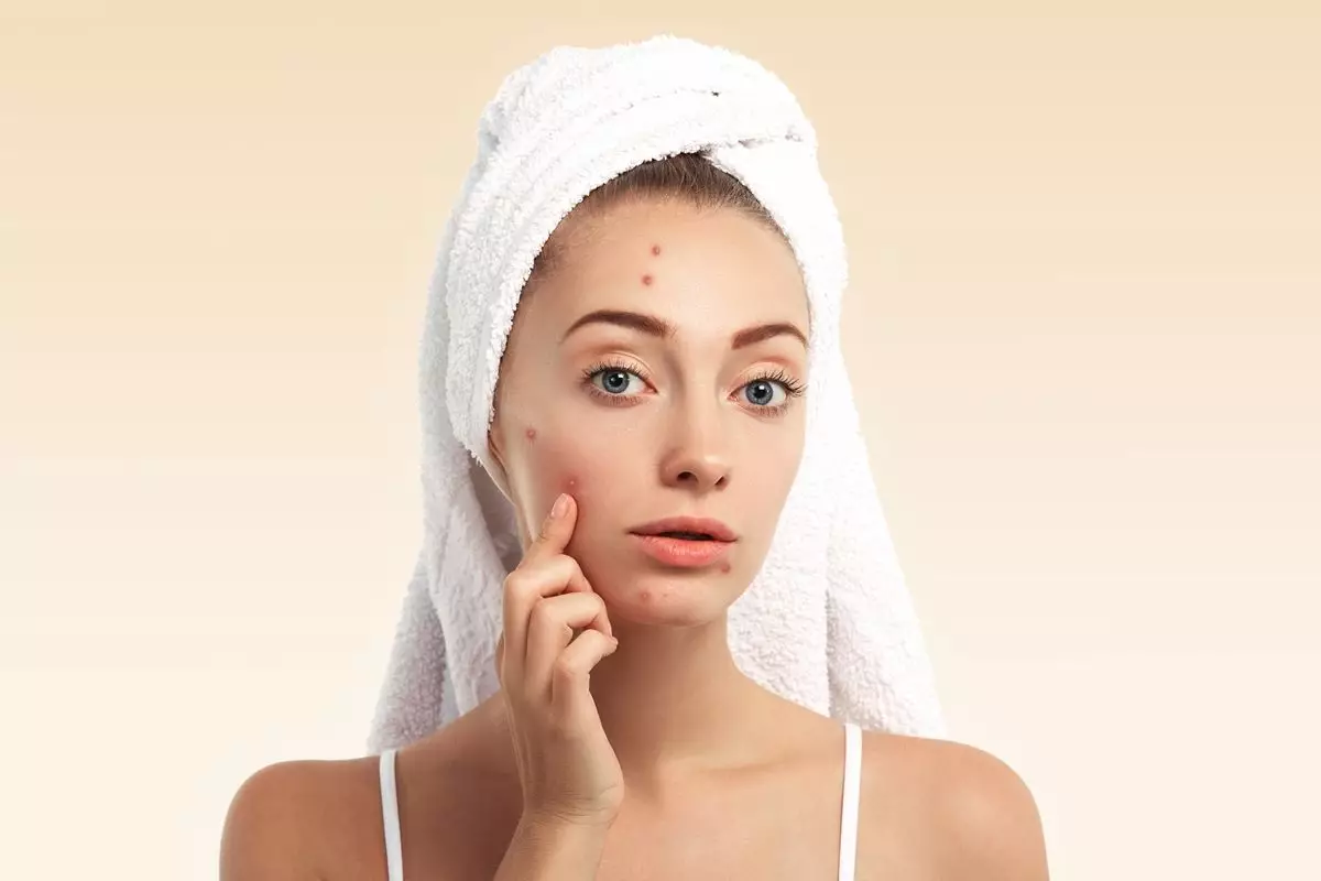 10 Skincare untuk kulit berminyak dan berjerawat di iklim tropis, harga di bawah Rp 100 ribu