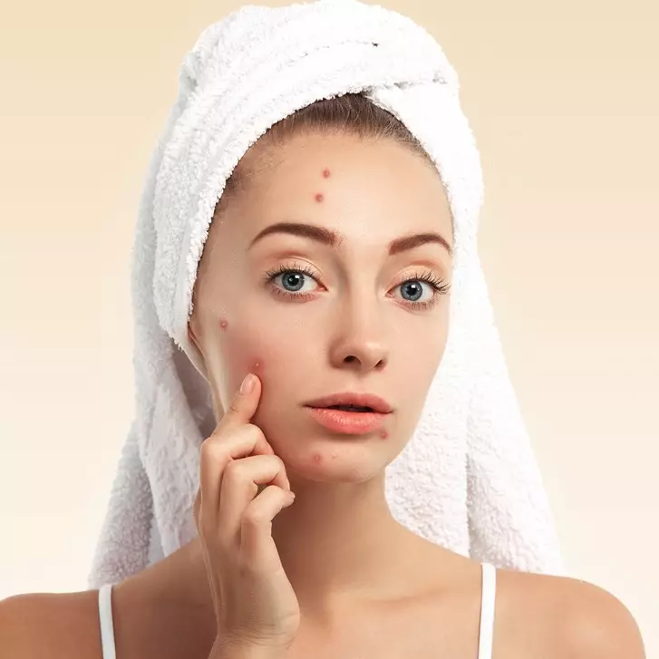 10 Skincare untuk kulit berminyak dan berjerawat di iklim tropis, harga di bawah Rp 100 ribu