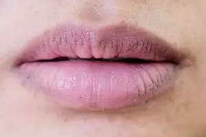 Ingin punya bibir lembap dan pink alami? Ini cara mendapatkannya pakai scrub dari bahan alami