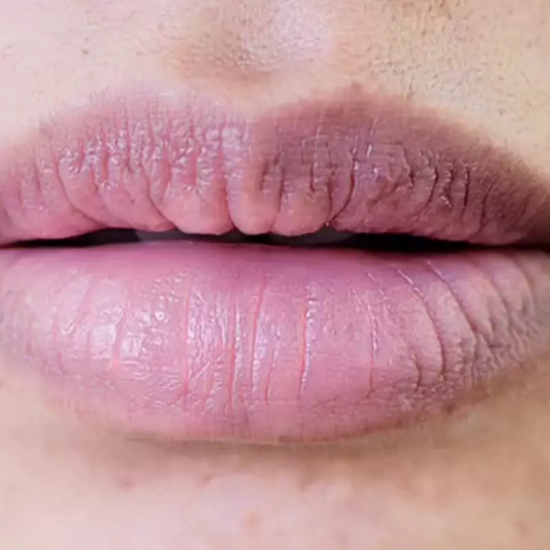 Ingin punya bibir lembap dan pink alami? Ini cara mendapatkannya pakai scrub dari bahan alami