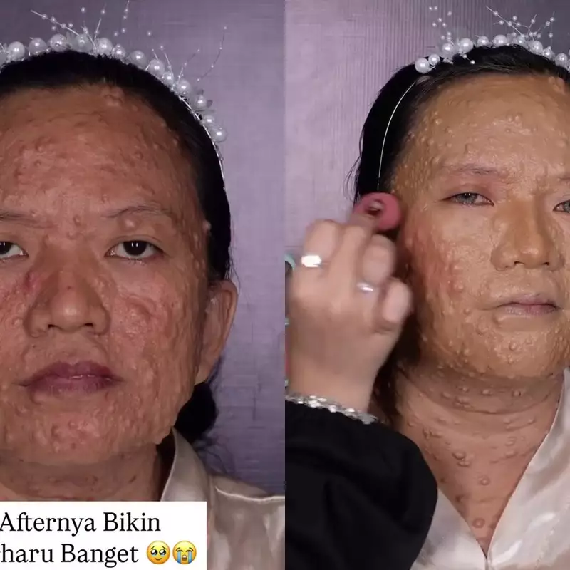 Makeup bikin glow-up, transformasi cewek dengan kulit bertekstur dirias soft ini auto jadi pangling