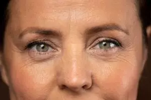 Rahasia menghilangkan keriput di bawah mata ini praktis cuma butuh eye patch dari 2 jenis tanaman
