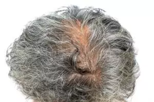 Cara ampuh hilangkan uban agar rambut hitam berkilau alami tanpa semir, cukup pakai 3 bahan dapur ini