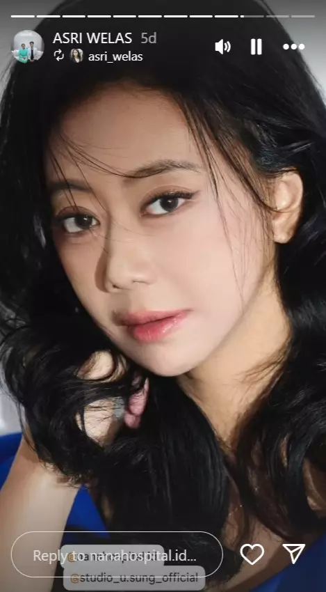 Alasan Asri Welas oplas wajah © Instagram Alasan Asri Welas oplas wajah © Instagram