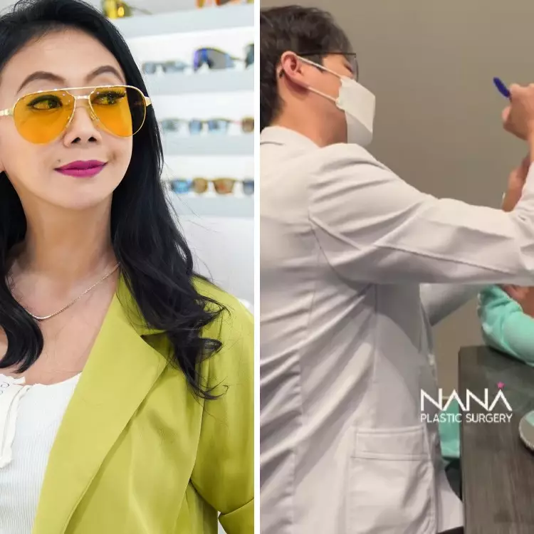 Alasan Asri Welas rogoh kocek Rp500 juta untuk oplas wajah dan tubuh, sebut demi kepentingan kerja