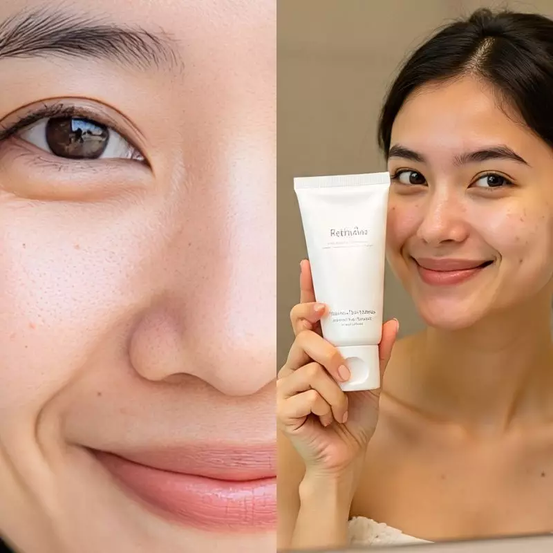 Retinol vs salicylic acid, mana yang paling efektif mengecilkan pori-pori