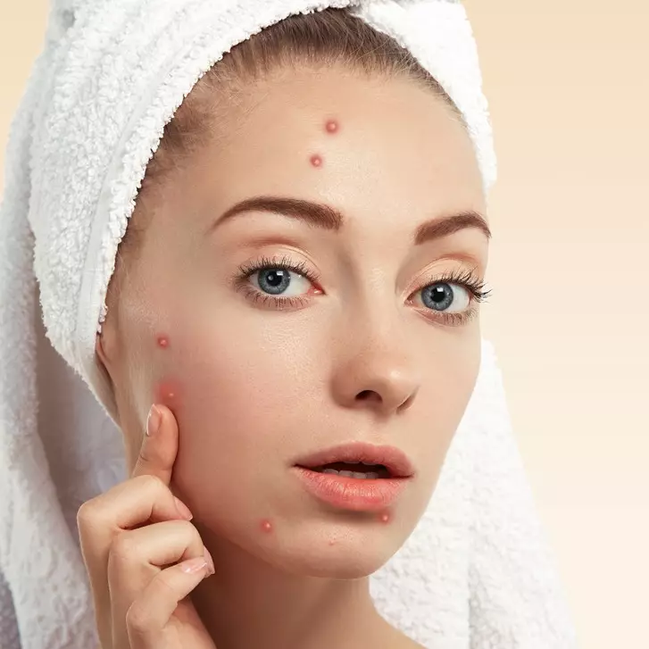 10 Pelembap untuk menghilangkan bekas jerawat harga di bawah Rp 100 ribu