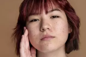 Bukan retinol, cara jitu eksfoliasi wajah ini bikin mulus dan pori-pori bersih pakai 2 bahan dapur