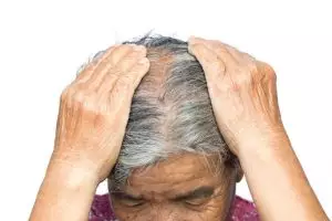 Solusi mengatasi uban secara alami tanpa disemir, rahasianya di 2 bahan dapur ini