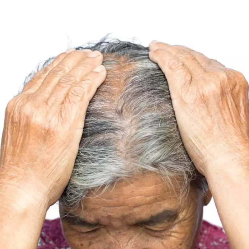 Solusi mengatasi uban secara alami tanpa disemir, rahasianya di 2 bahan dapur ini