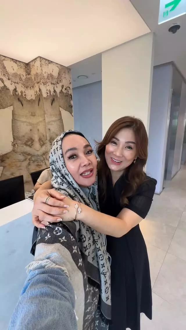Dewi Gita rogoh ratusan juta demi oplas © Instagram