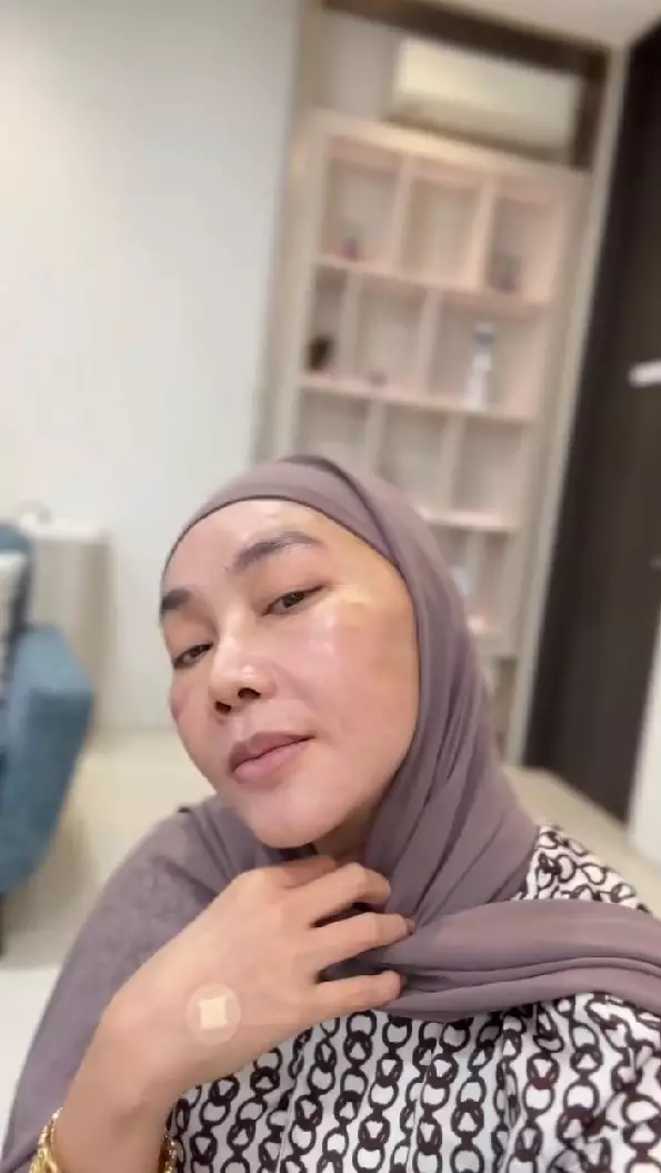 Dewi Gita rogoh ratusan juta demi oplas © Instagram