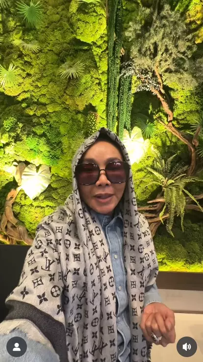 Dewi Gita rogoh ratusan juta demi oplas © Instagram