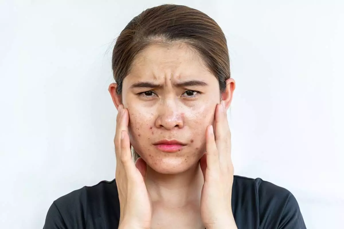 Samarkan pori-pori agar wajah bebas minyak pakai 1 jenis minuman, kini tak ribet touch-up makeup