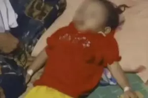 Nasib tragis, Raya balita 3 tahun, tubuh dan otak penuh cacing, orang tua ODGJ, tak punya BPJS