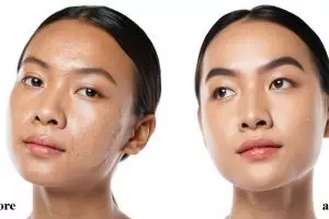 10 Teknik mengaplikasikan foundation agar pori-pori wajah tak nampak, makeup flawless sepanjang hari