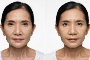 Kerutan di usia 50-an? Coba cara sederhana ini biar kulit tetap kencang