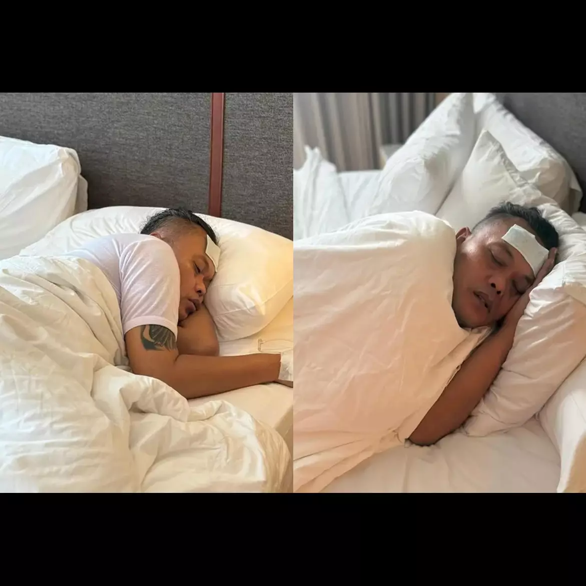 Sule terpaksa diinfus di hotel Indramayu, penyebab kondisinya terungkap